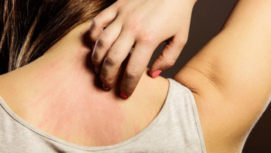 Doctors Explain How Kidney Disorders Can Show Up Through Skin Changes