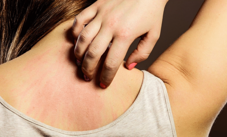 Doctors Explain How Kidney Disorders Can Show Up Through Skin Changes