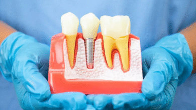 Why Gum Health Is The Key To Successful Implant Dentistry