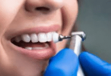 6 Benefits Of Professional Dental Cleanings In General Practice