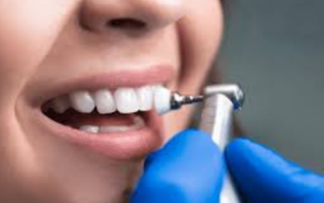 6 Benefits Of Professional Dental Cleanings In General Practice