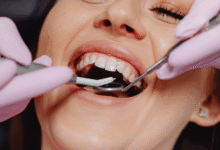 6 Ways to Not Let a Chipped Tooth Define You