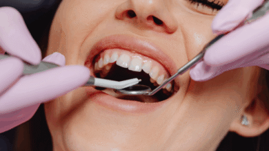6 Ways to Not Let a Chipped Tooth Define You