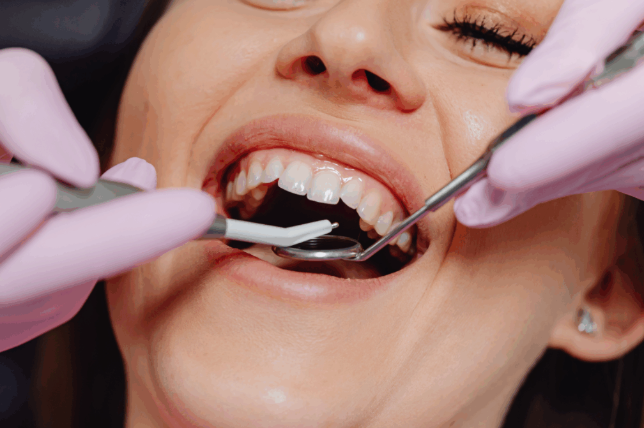 6 Ways to Not Let a Chipped Tooth Define You