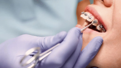 Why Orthodontists Are Essential For Complex Dental Cases