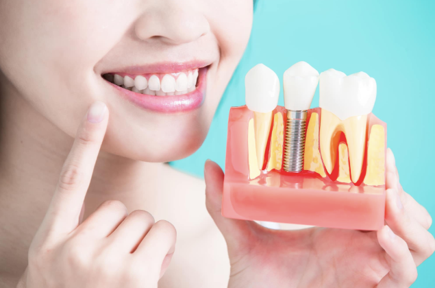 6 Tips For Caring For Dental Implants After Surgery