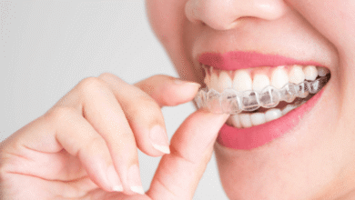 3 Ways Clear Aligners Improve Comfort During Treatment