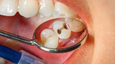 Why Fluoride Treatments Protect Against Generational Cavity Risks