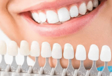 4 Cosmetic Dental Options Families Often Consider Together