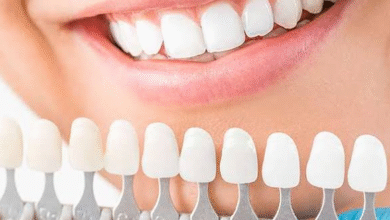 4 Cosmetic Dental Options Families Often Consider Together
