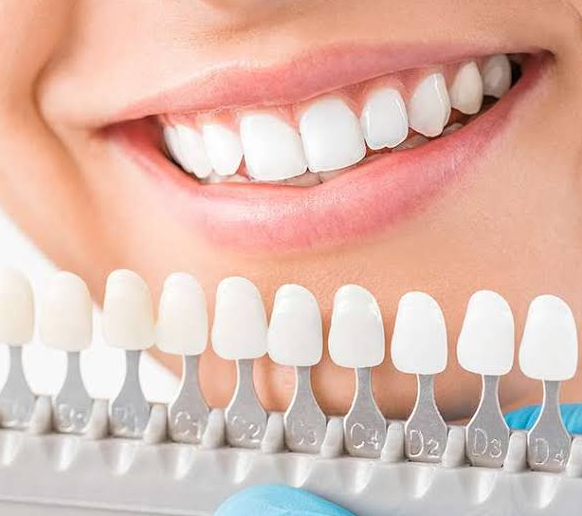4 Cosmetic Dental Options Families Often Consider Together