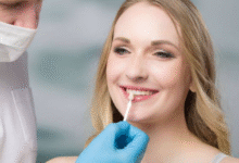 5 Questions Families Ask Most About Veneers And Dental Bonding