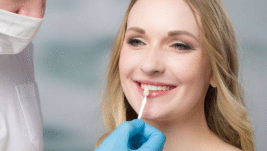 5 Questions Families Ask Most About Veneers And Dental Bonding