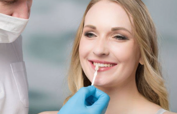 5 Questions Families Ask Most About Veneers And Dental Bonding
